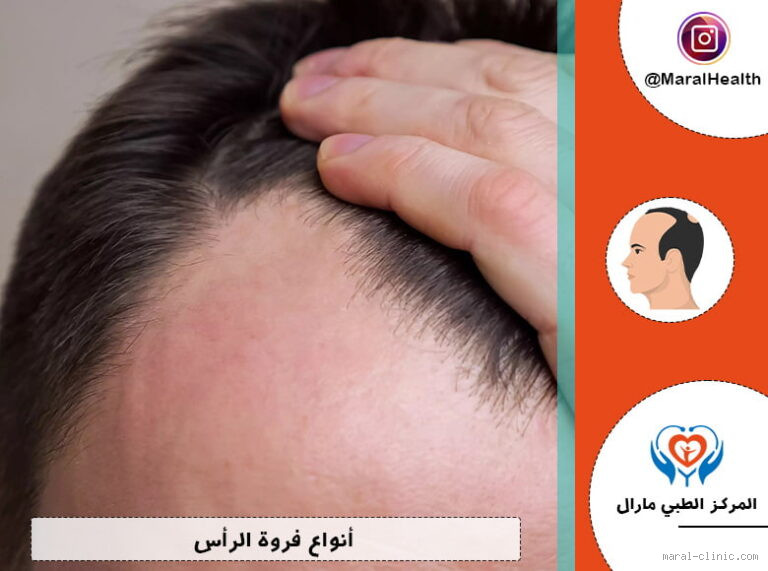 هل فرك فروة الرأس ينبت الشعر؟ اكتشف الحقيقة الآن