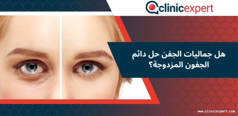 هل الجفون المزدوجة من علامات الجمال؟ تعرف على الإجابة!