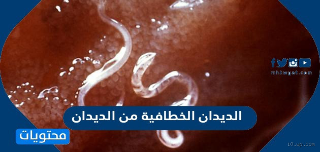 هل الديدان تسبب نحافة الوجه؟ الحقيقة التي لا يخبرك بها أحد!