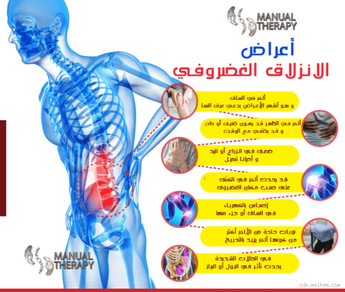 هل المساج مضر للانزلاق الغضروفي؟ اكتشف الحقيقة