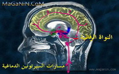 هل السيروتونين له علاقة بالقولون العصبي؟ اكتشف الحقيقة