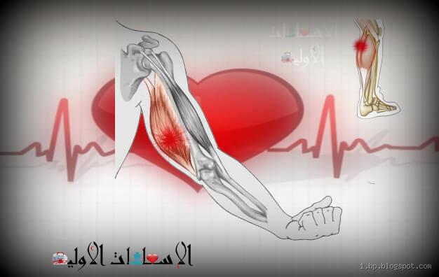 هل التشنج طبيعي؟ تعرف على الأسباب والحلول