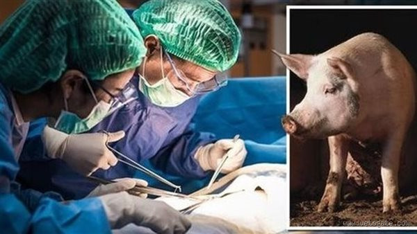 هل يجوز استخدام أعضاء الخنزير للإنسان؟ تساؤلات شرعية وعلمية