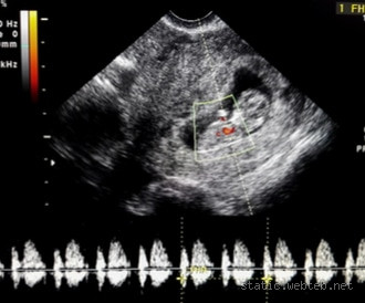 هل يوجد نبض في الشهر الأول من الحمل؟ كل ما تحتاج معرفته