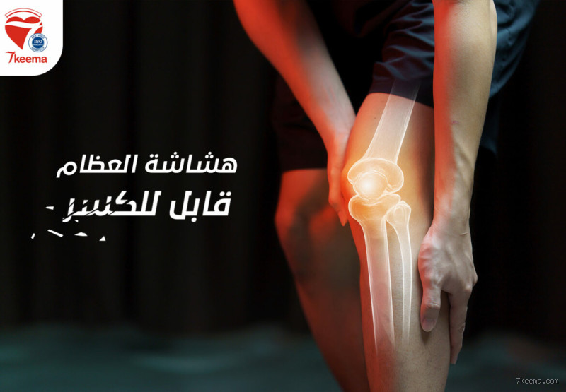 كيف تمنع التعرق تحت الإبط؟ طرق فعالة للتخلص من المشكلة