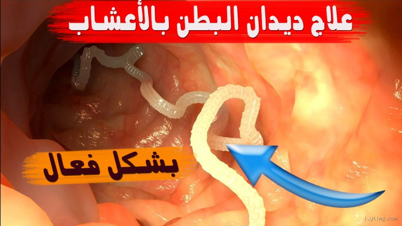 كيف تطرد الديدان من البطن؟