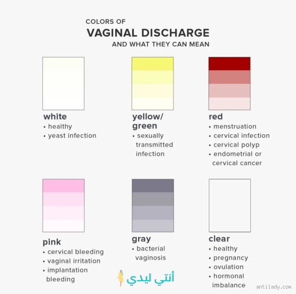 أسباب التغيرات في سائل المهبل: متى يكون طبيعيًا ومتى يجب القلق؟