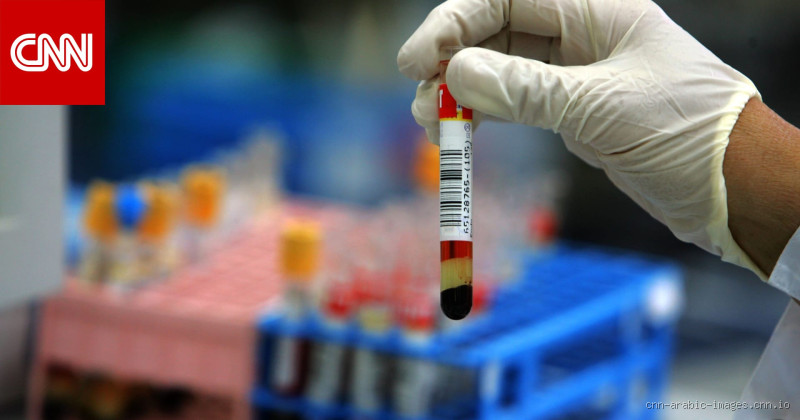 ما هو المشروب الذي يخفض الكولسترول؟ اكتشف الحلول الفعالة