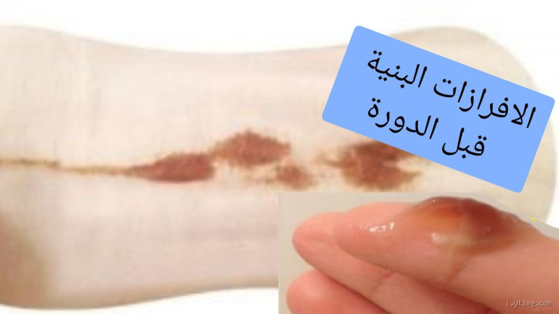 ما سبب نزول إفرازات بنية بدون دورة؟ الأسباب والحلول