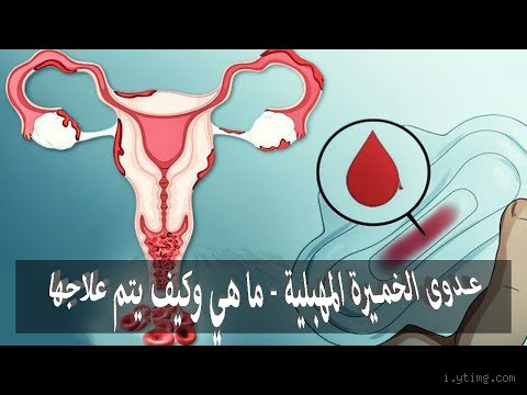 ما سبب رائحة الخميرة في المهبل؟ إليك الإجابة الصادقة