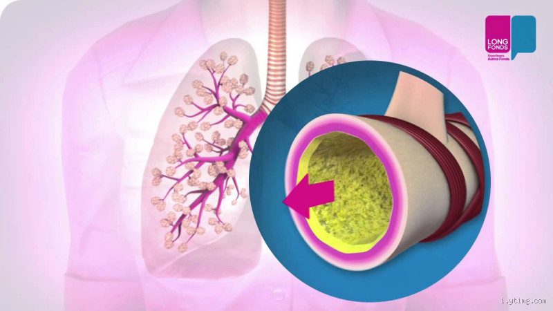 ماذا يفتح الشعب الهوائية؟ تعرف على الطرق الطبيعية والطبية