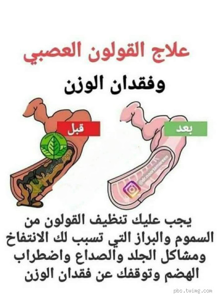 ماذا يأكل من يعاني من القولون العصبي؟ نصائح غذائية للتخفيف من الأعراض