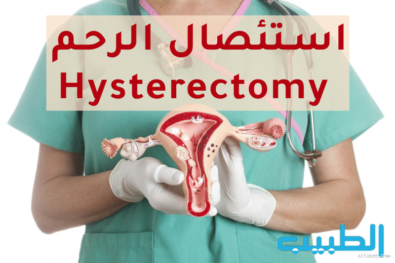 متى يمكن ممارسة العلاقة الزوجية بعد عملية استئصال الرحم؟