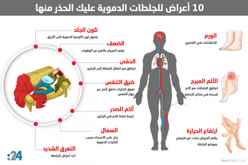 متى يسبب الضغط جلطة؟ كل ما تحتاج معرفته عن العلاقة بين الضغط والجلطات